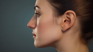 Nose Surgery (Rhinoplasty) in Ingersoll, ON